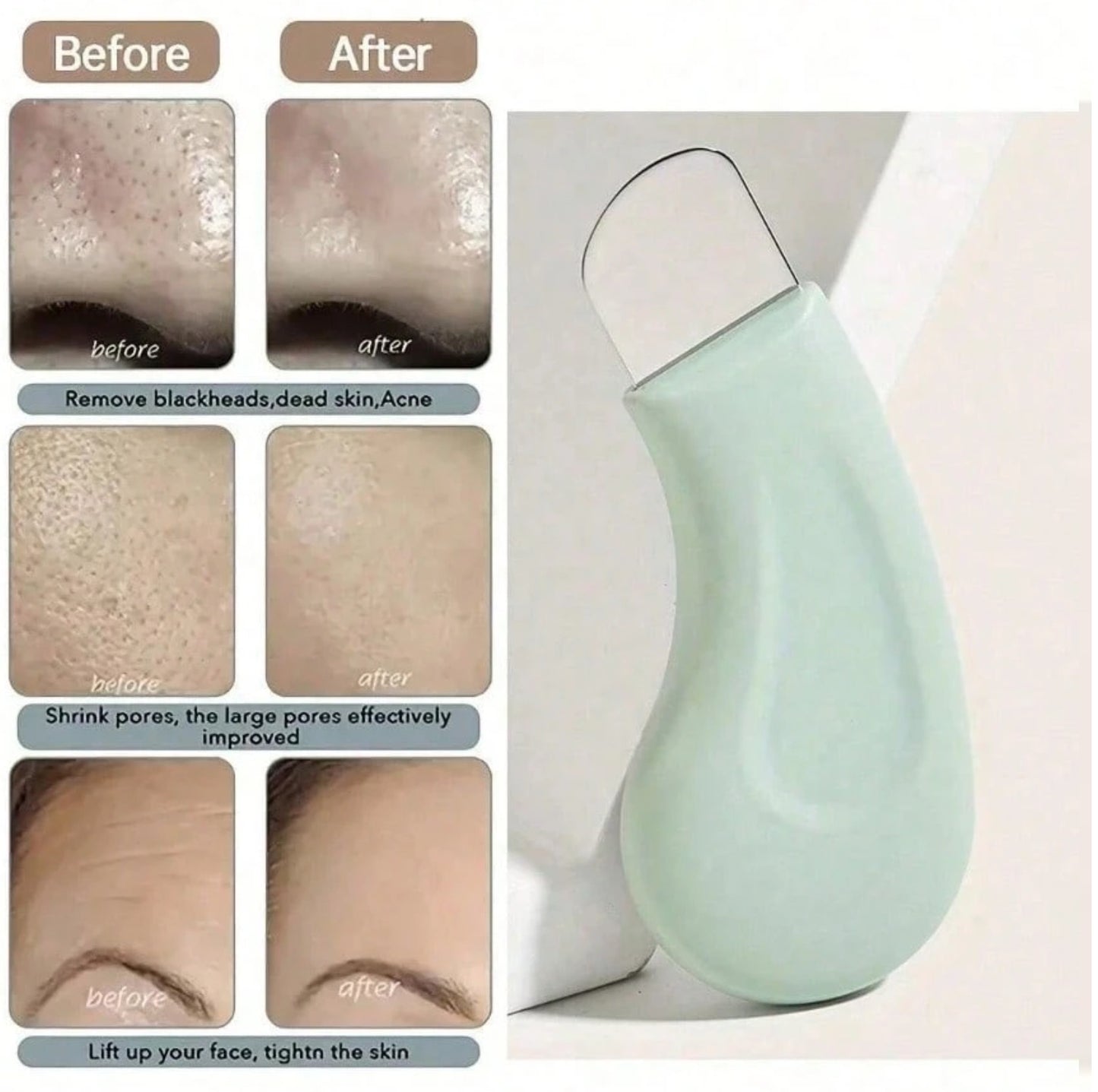 Blackhead Remover Tool