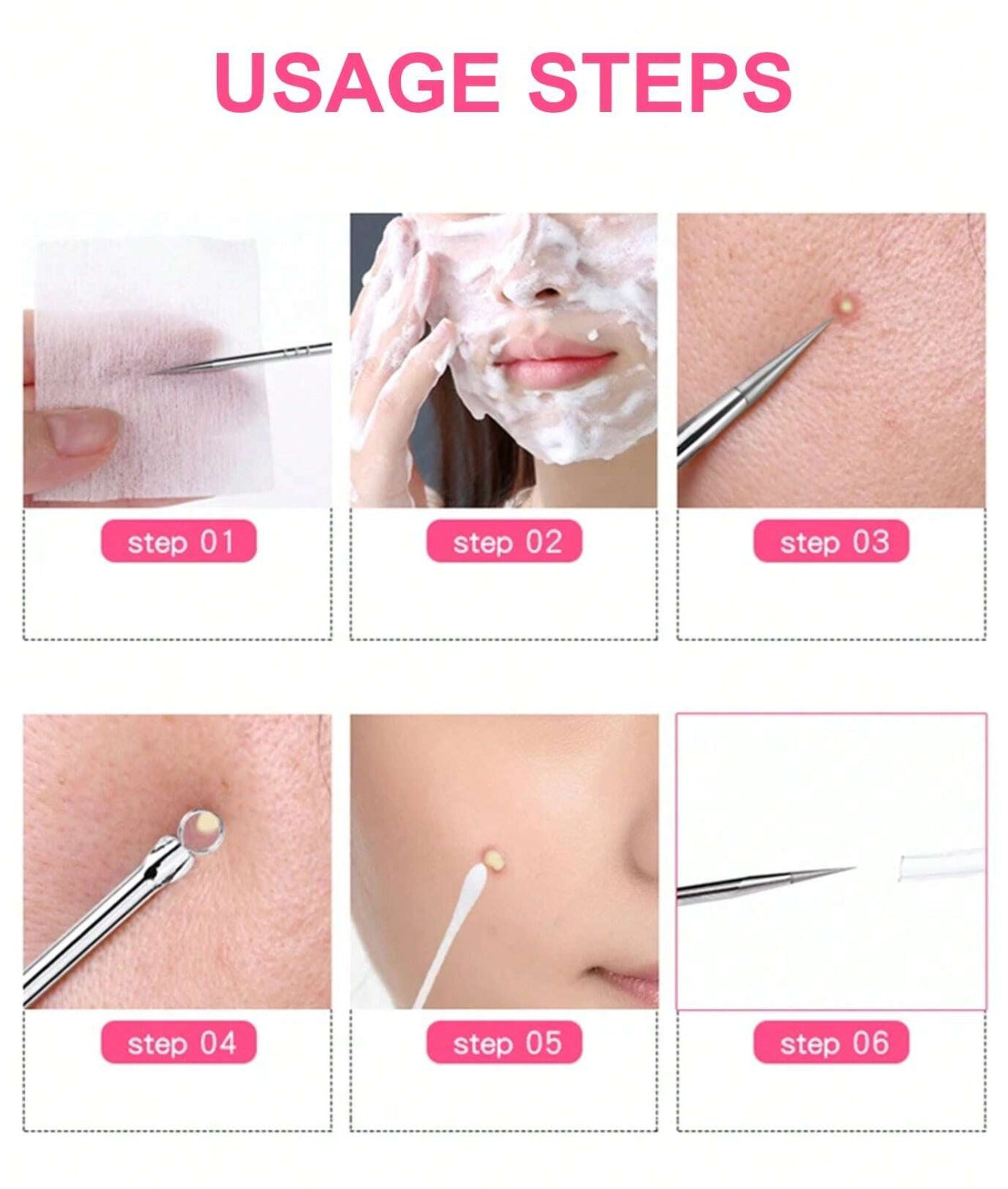 Stainless Steel Blackhead Remover Pin